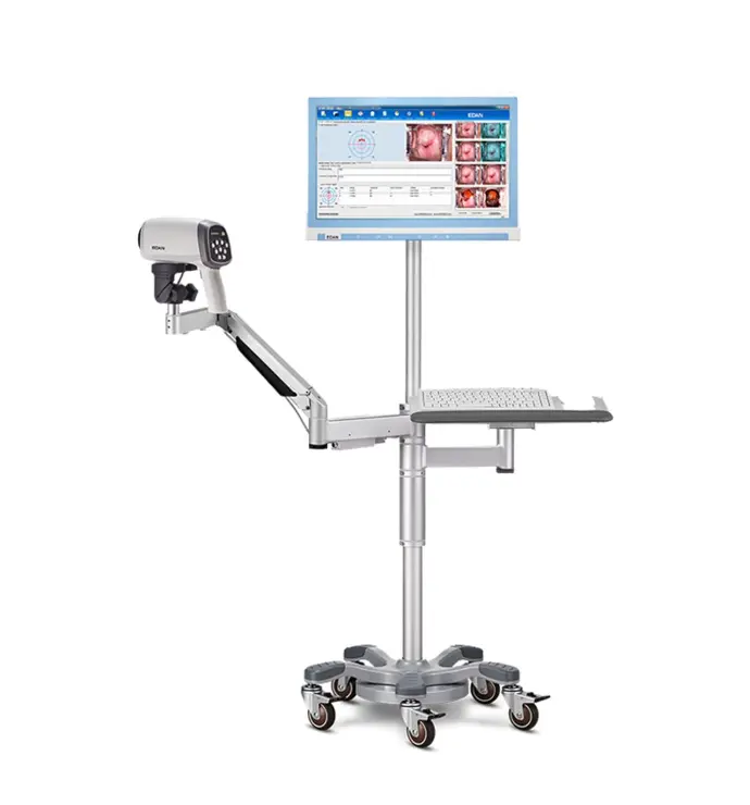 colposcopio edan brazo articulado para ginecologia