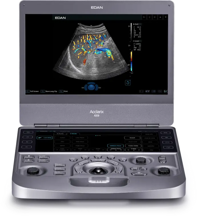 ecografo acclarix ax9