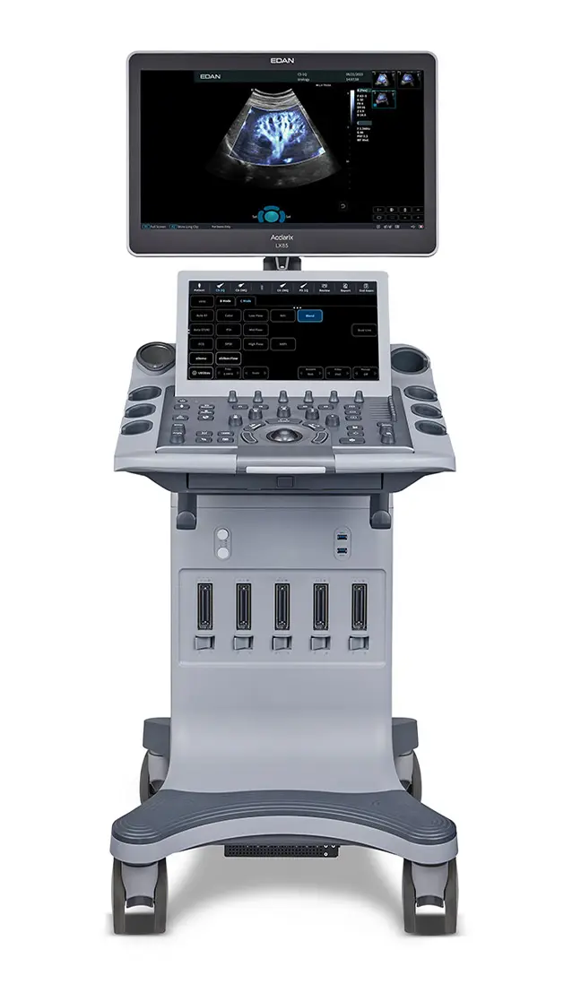ecografo edan lx85