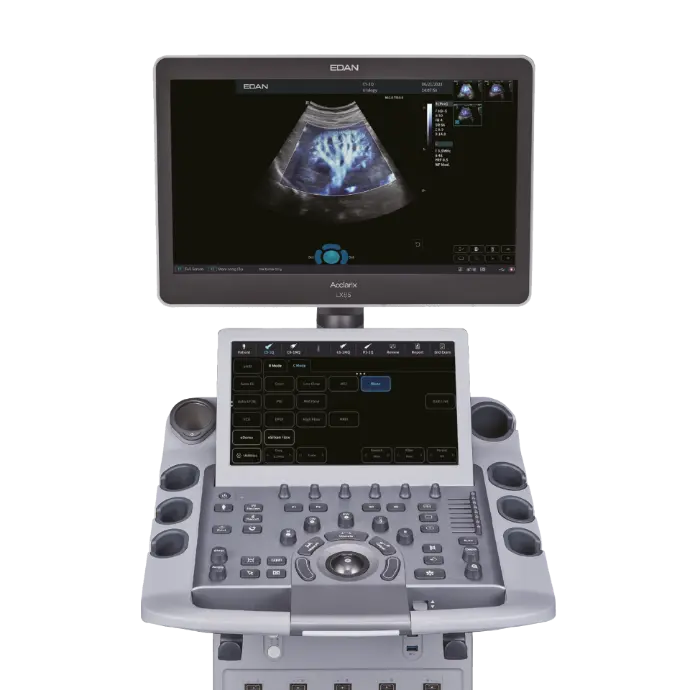 venta de ecografo edan lx85 en peru 