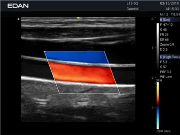 Conexiones del Edan AX3 con puerto para transductores y batería dual