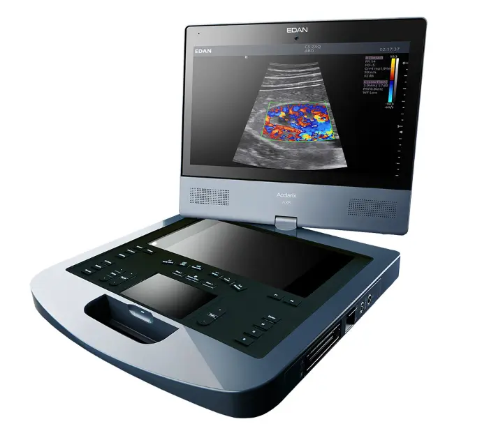 Ecógrafo Edan AX8 portátil de alta gama con pantalla táctil